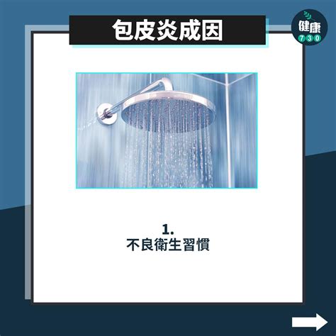 龜頭損左|【包皮炎】認識成因、症狀＋3個治療建議！（附中醫。